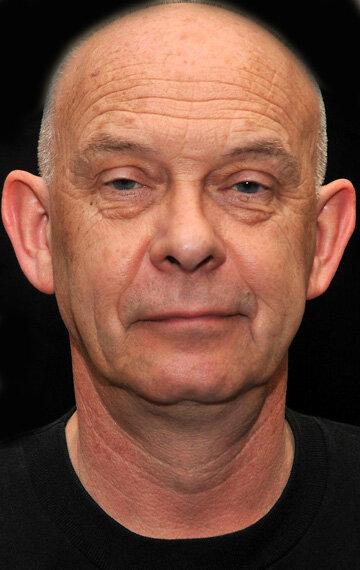 Doug Bradley