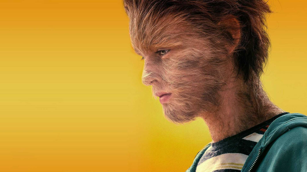 Реальная история мальчика-волчонка