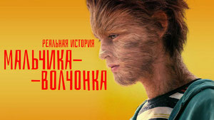 Реальная история мальчика-волчонка